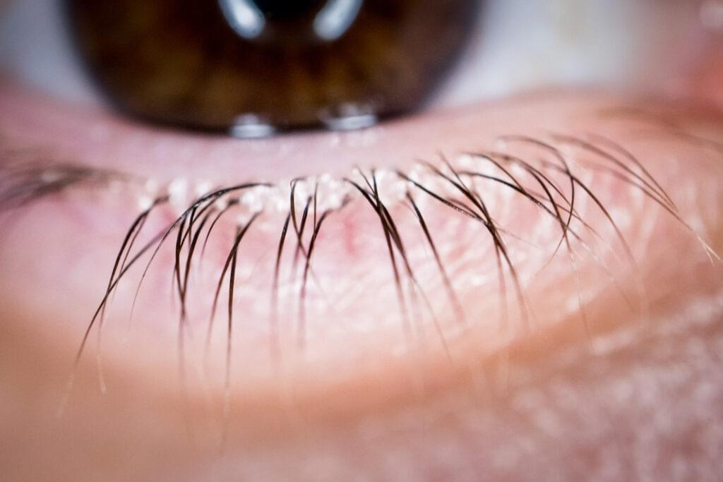 5 Natural Ways To Grow Eyelashes