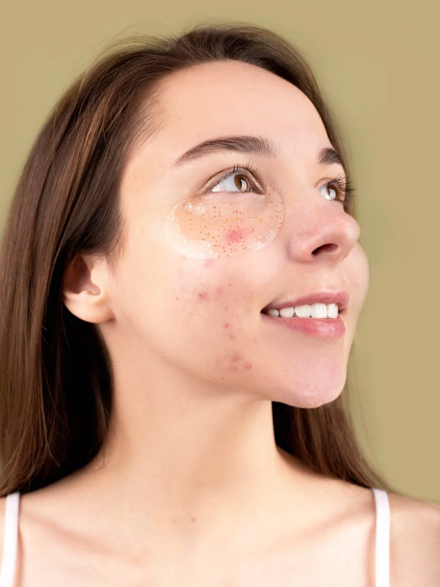 How do Pimple Patches work and how to use them?