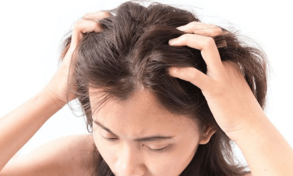 Know the Difference Between Dry Scalp vs Dandruff: